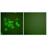 Immunofluorescence - Anti-Keratin 10 Antibody (C0249) - Antibodies.com