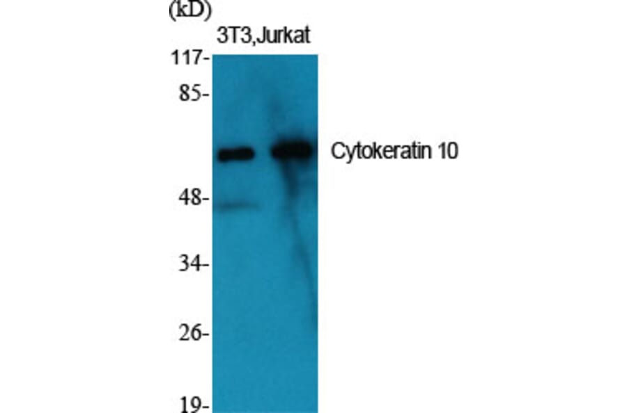 Western Blot - Anti-Keratin 10 Antibody (C0249) - Antibodies.com