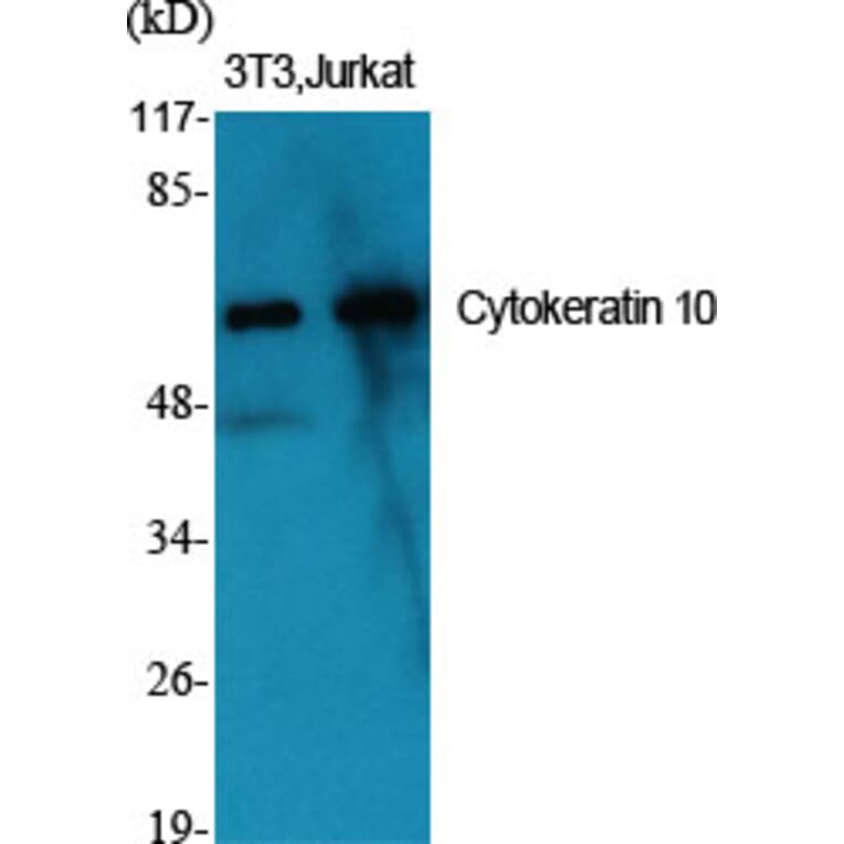 Western Blot - Anti-Keratin 10 Antibody (C0249) - Antibodies.com