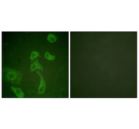 Immunofluorescence - Anti-IL-2R beta Antibody (B1060) - Antibodies.com