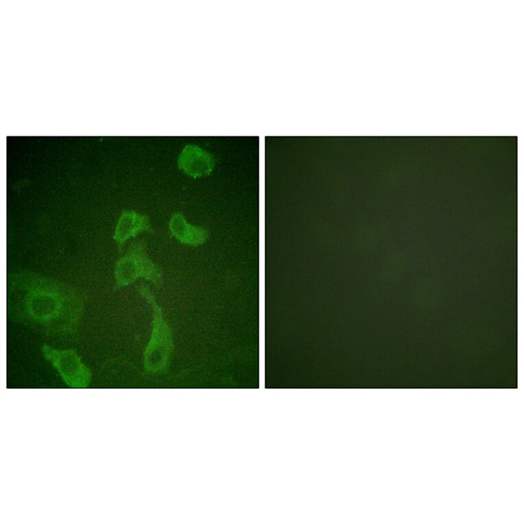 Immunofluorescence - Anti-IL-2R beta Antibody (B1060) - Antibodies.com