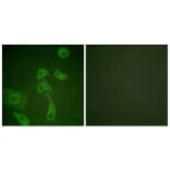 Immunofluorescence - Anti-IL-2R beta Antibody (B1060) - Antibodies.com