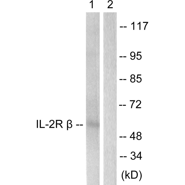 Western Blot - Anti-IL-2R beta Antibody (B1060) - Antibodies.com