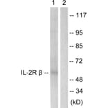 Western Blot - Anti-IL-2R beta Antibody (B1060) - Antibodies.com