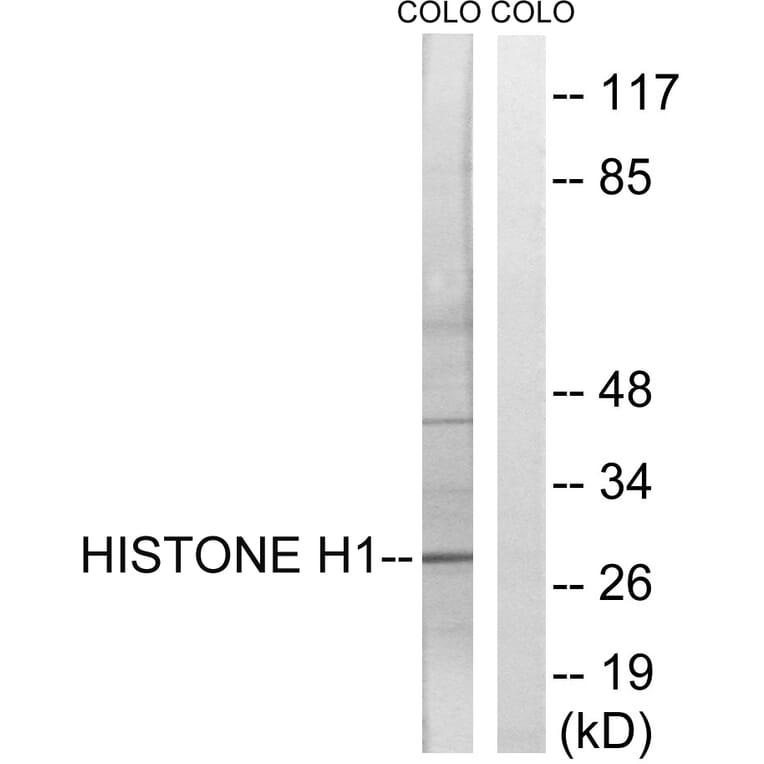 Western Blot - Anti-Histone H1 Antibody (B0948) - Antibodies.com