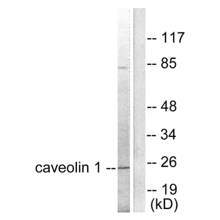 Western Blot - Anti-Caveolin-1 Antibody (C0139) - Antibodies.com