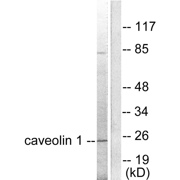 Western Blot - Anti-Caveolin-1 Antibody (C0139) - Antibodies.com