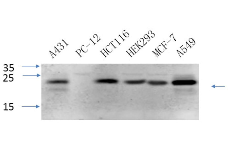 Western Blot - Anti-Caveolin-1 Antibody (C0139) - Antibodies.com
