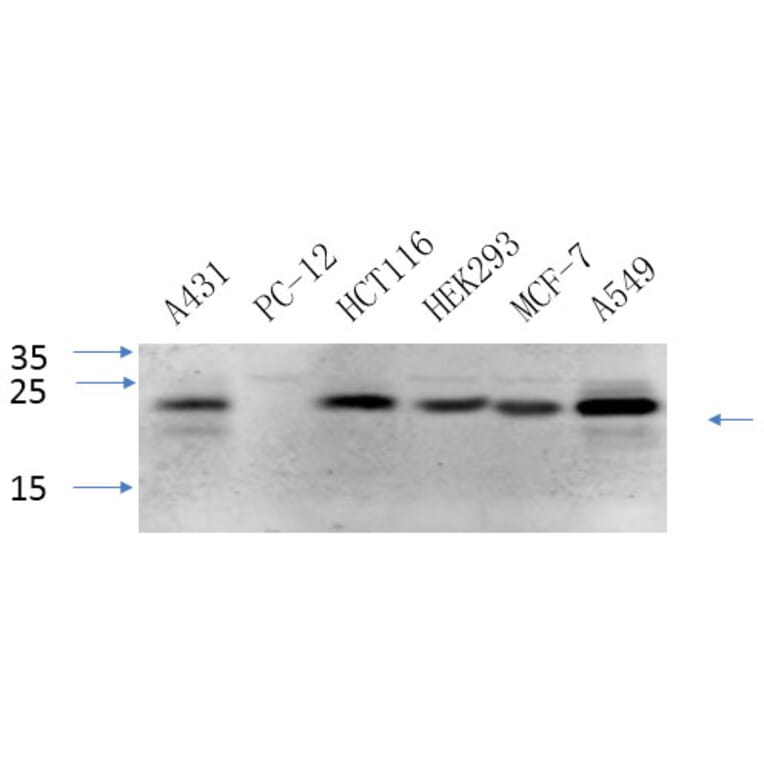 Western Blot - Anti-Caveolin-1 Antibody (C0139) - Antibodies.com