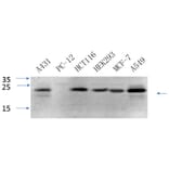 Western Blot - Anti-Caveolin-1 Antibody (C0139) - Antibodies.com