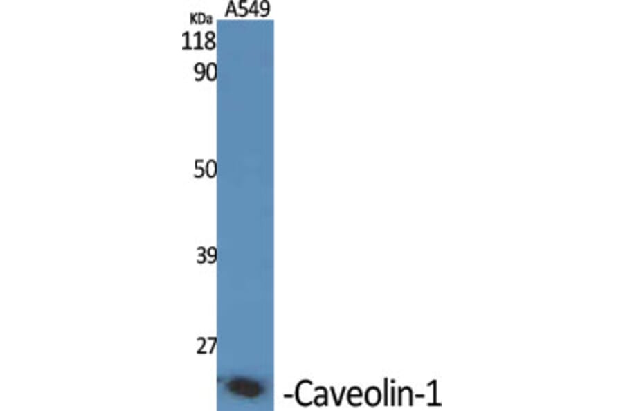 Immunohistochemistry - Anti-Caveolin-1 Antibody (C0139) - Antibodies.com