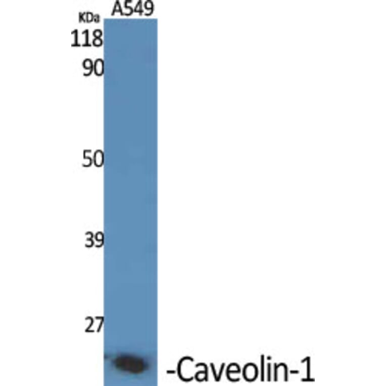 Immunohistochemistry - Anti-Caveolin-1 Antibody (C0139) - Antibodies.com