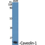 Immunohistochemistry - Anti-Caveolin-1 Antibody (C0139) - Antibodies.com
