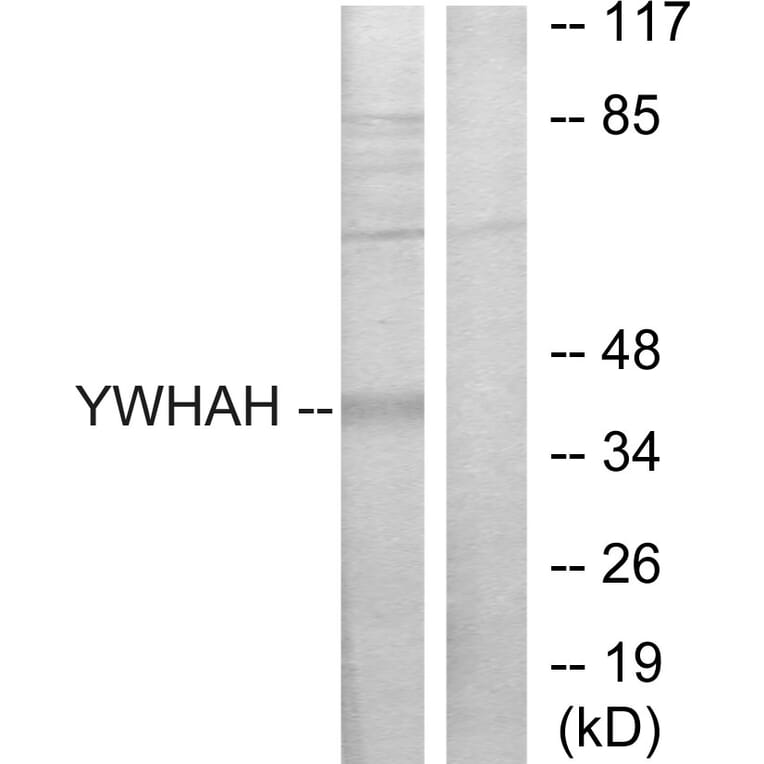 Western Blot - Anti-14-3-3 eta Antibody (C12003) - Antibodies.com