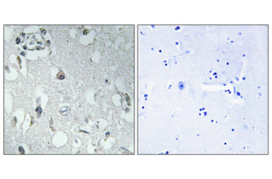 Immunohistochemistry - Anti-14-3-3 eta Antibody (C12003) - Antibodies.com