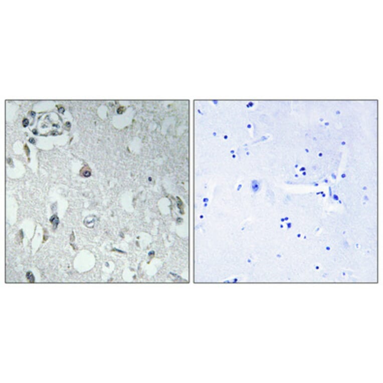 Immunohistochemistry - Anti-14-3-3 eta Antibody (C12003) - Antibodies.com