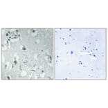 Immunohistochemistry - Anti-14-3-3 eta Antibody (C12003) - Antibodies.com
