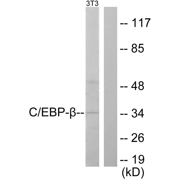 Western Blot - Anti-CEBP beta Antibody (B0057) - Antibodies.com