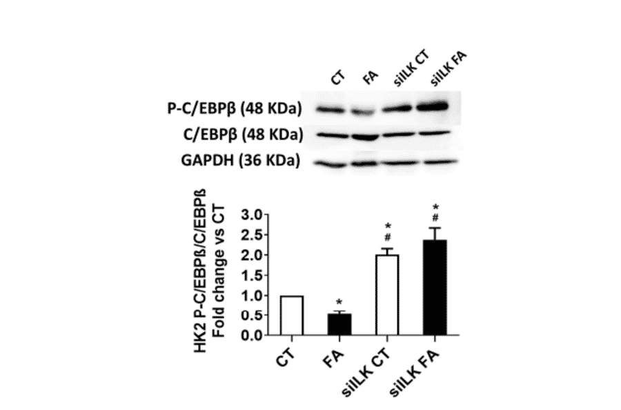 Validation Data - Anti-CEBP beta Antibody (A95167)