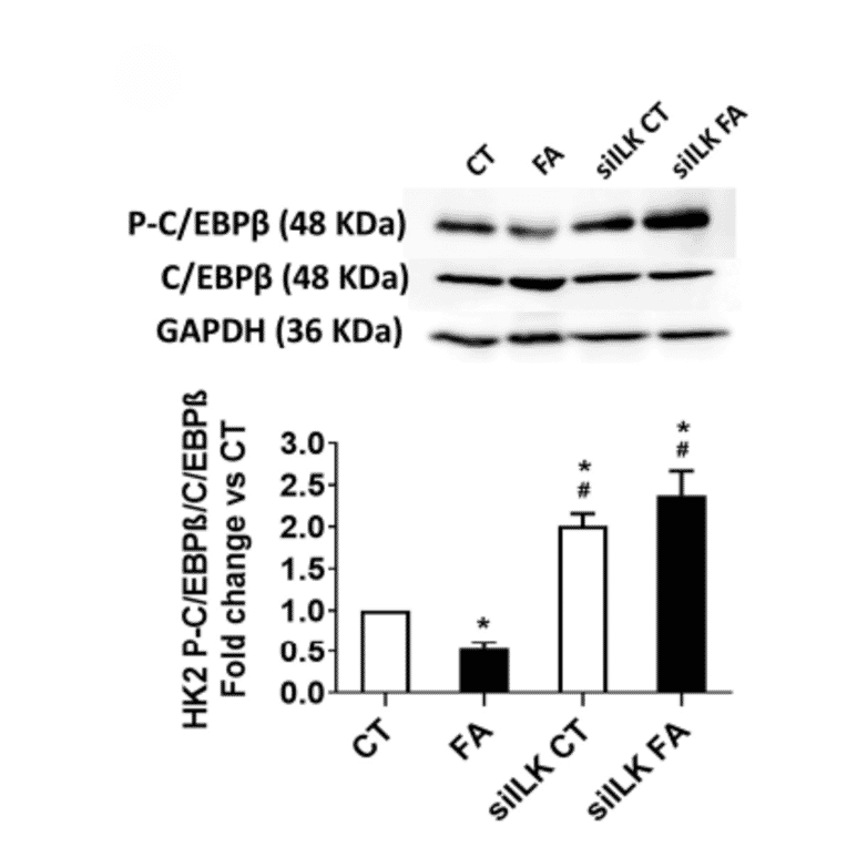 Validation Data - Anti-CEBP beta Antibody (A95167)