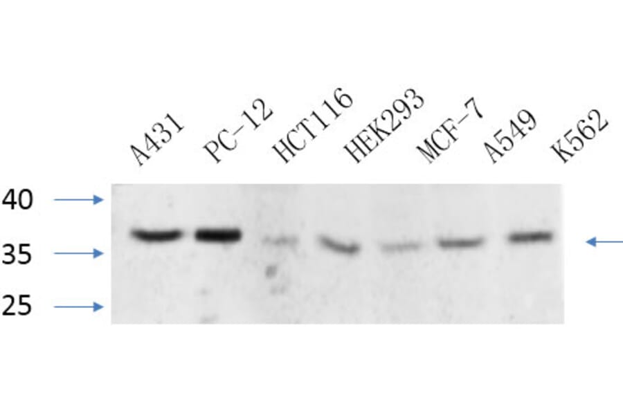 Western Blot - Anti-CEBP beta Antibody (B0057) - Antibodies.com