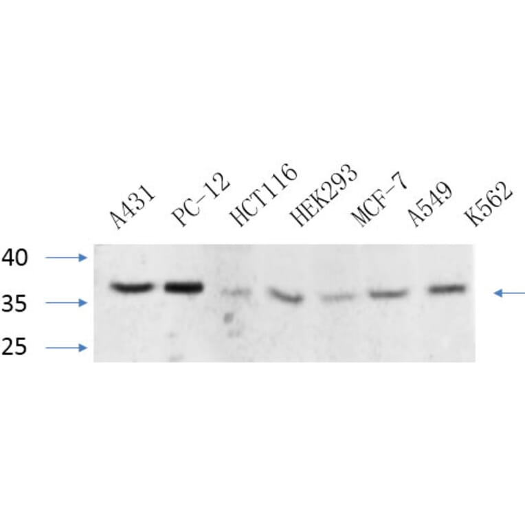 Western Blot - Anti-CEBP beta Antibody (B0057) - Antibodies.com