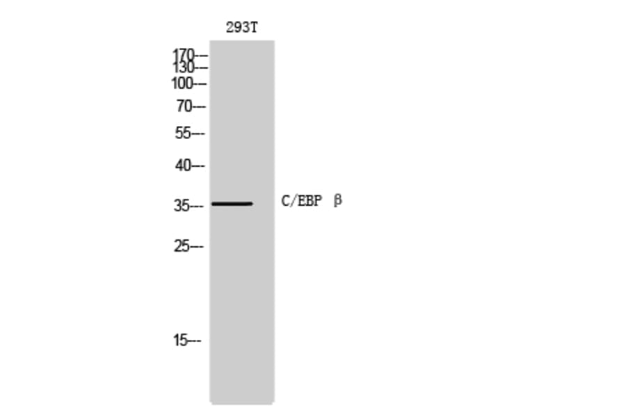 Immunohistochemistry - Anti-CEBP beta Antibody (B0057) - Antibodies.com