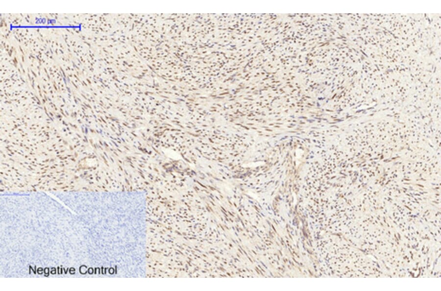 Immunohistochemistry - Anti-CEBP beta Antibody (B0057) - Antibodies.com
