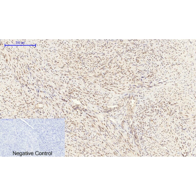 Immunohistochemistry - Anti-CEBP beta Antibody (B0057) - Antibodies.com