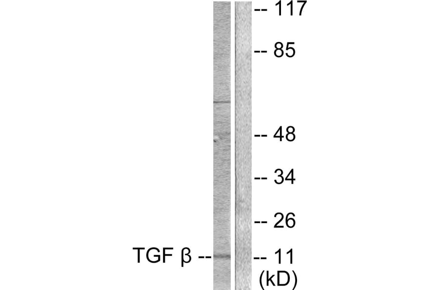 Western Blot - Anti-TGF beta3 Antibody (C0342) - Antibodies.com