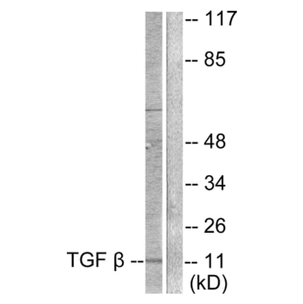 Western Blot - Anti-TGF beta3 Antibody (C0342) - Antibodies.com