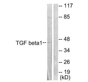 Western Blot - Anti-TGF beta1 Antibody (C0340) - Antibodies.com