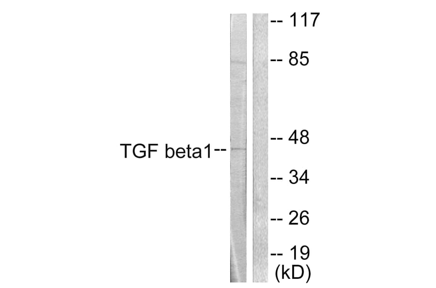 Western Blot - Anti-TGF beta1 Antibody (C0340) - Antibodies.com