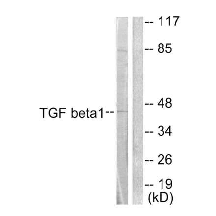 Western Blot - Anti-TGF beta1 Antibody (C0340) - Antibodies.com