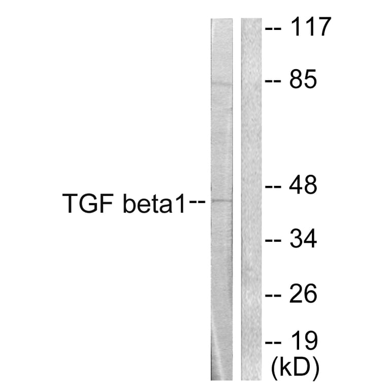 Western Blot - Anti-TGF beta1 Antibody (C0340) - Antibodies.com