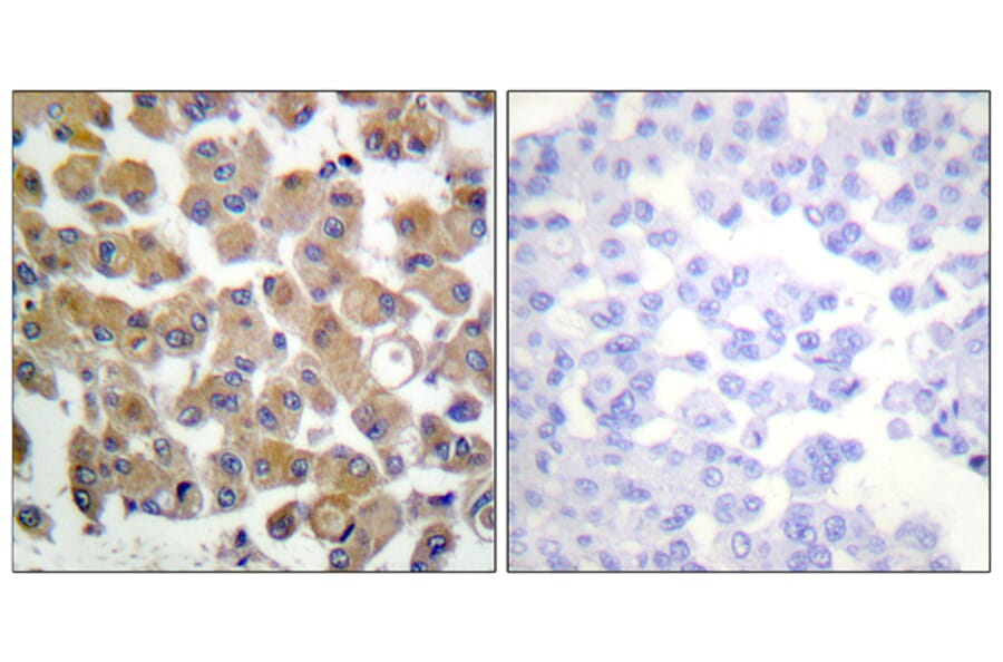 Immunohistochemistry - Anti-TGF beta1 Antibody (C0340) - Antibodies.com