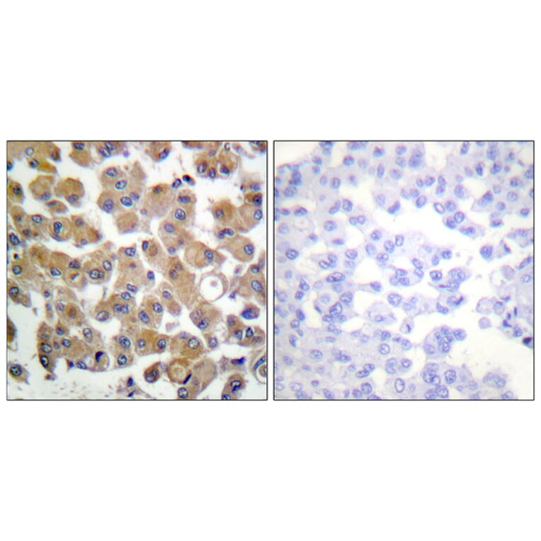 Immunohistochemistry - Anti-TGF beta1 Antibody (C0340) - Antibodies.com