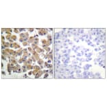 Immunohistochemistry - Anti-TGF beta1 Antibody (C0340) - Antibodies.com