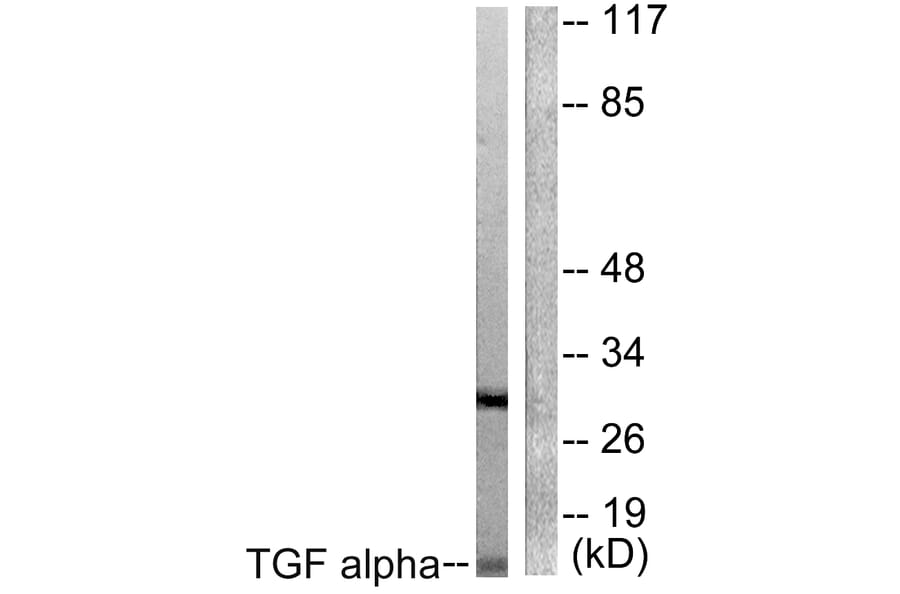 Western Blot - Anti-TGF alpha Antibody (C0343) - Antibodies.com