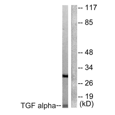 Western Blot - Anti-TGF alpha Antibody (C0343) - Antibodies.com