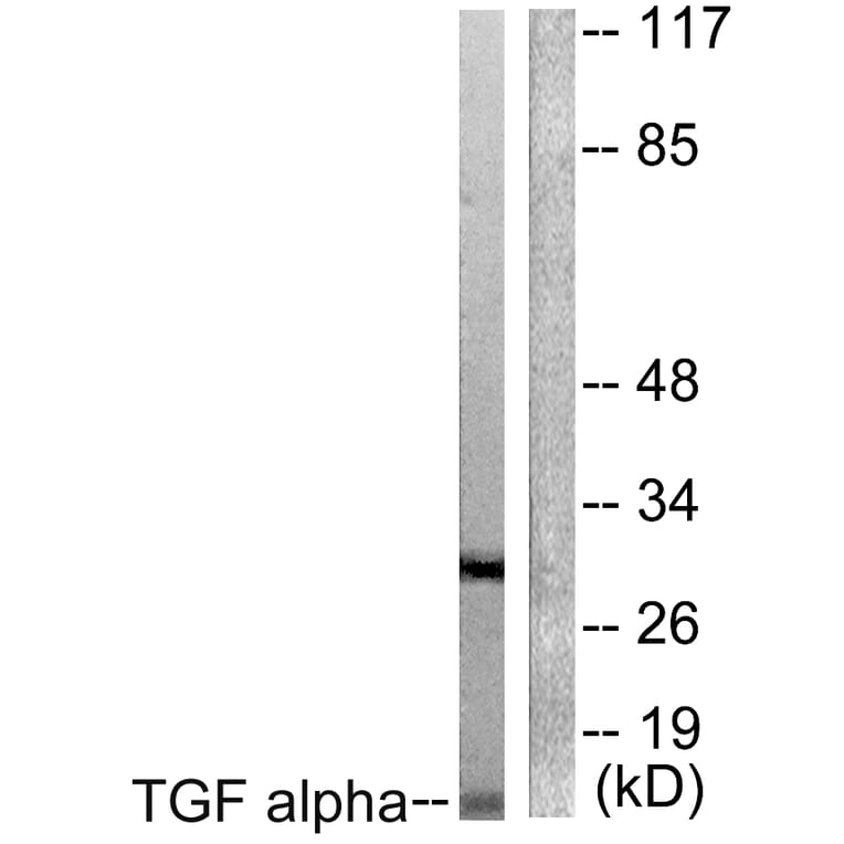 Western Blot - Anti-TGF alpha Antibody (C0343) - Antibodies.com