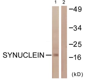 Western Blot - Anti-Synuclein Antibody (B0582) - Antibodies.com