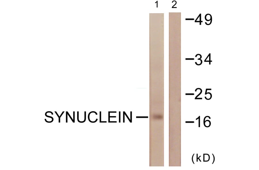 Western Blot - Anti-Synuclein Antibody (B0582) - Antibodies.com