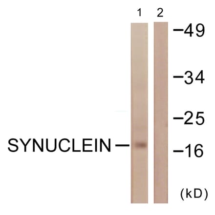 Western Blot - Anti-Synuclein Antibody (B0582) - Antibodies.com