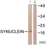 Western Blot - Anti-Synuclein Antibody (B0582) - Antibodies.com