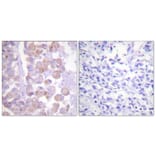 Immunohistochemistry - Anti-Synuclein Antibody (B0582) - Antibodies.com