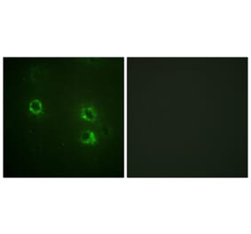 Immunofluorescence - Anti-Synapsin1 Antibody (B1009) - Antibodies.com