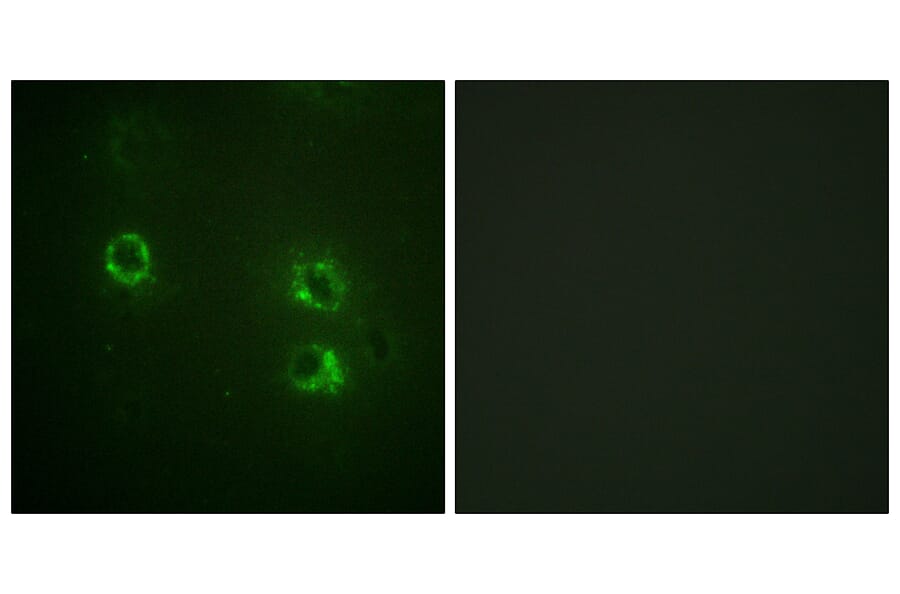 Immunofluorescence - Anti-Synapsin1 Antibody (B1009) - Antibodies.com