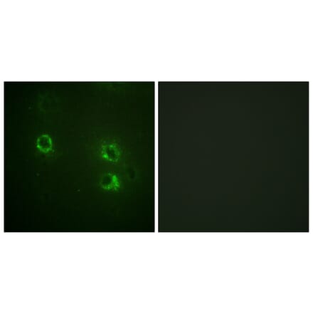 Immunofluorescence - Anti-Synapsin1 Antibody (B1009) - Antibodies.com