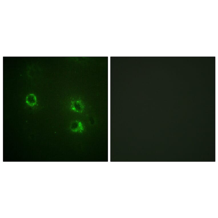 Immunofluorescence - Anti-Synapsin1 Antibody (B1009) - Antibodies.com